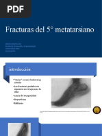 Clasificación y tratamiento de fractura de Jones | PDF | Hueso ...