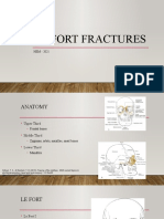 Le Fort Fractures