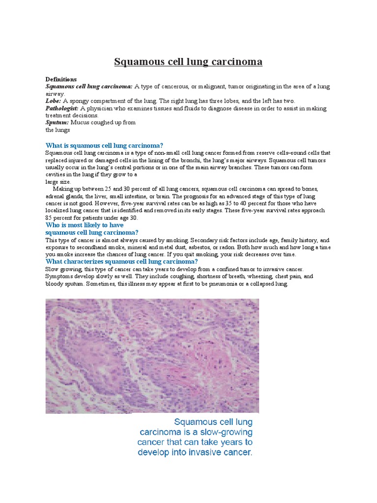Squamous Cell Lung Carcinoma | PDF | Lung Cancer | Pathology