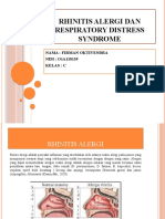 Rhinitis Alergi Dan Respiratory Distress Syndrome