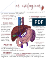 Varices Esofagicas 