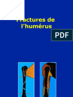 08 - Humerus - Fractures