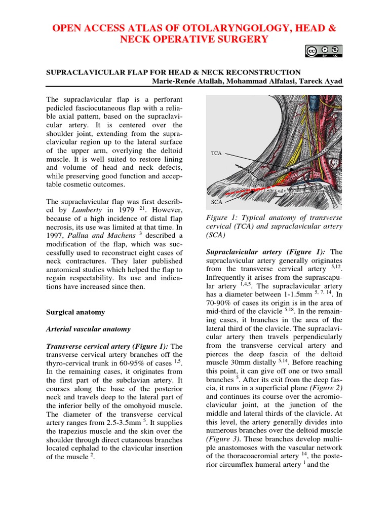 Supraclavicular Flap For Head Neck Reconstruction PDF