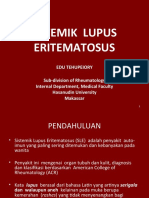 Sistemik Lupus Eritematosus