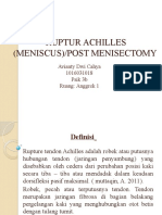 Soca Ruptur Achilles (Meniscus) Post Menisectomy