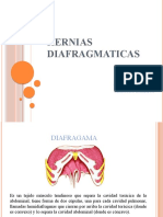Hernias Diafragmaticas