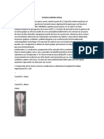 Tecnica Corono Apical