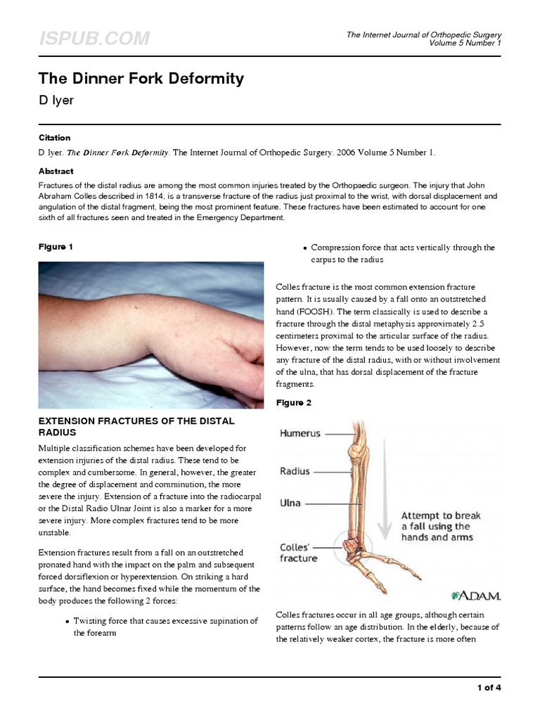 The Dinner Fork Deformity D Iyer PDF Musculoskeletal System Limbs (Anatomy)