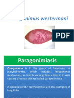 Paragonimus westermani Lung Fluke Infection