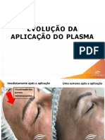 RESULTADO_FACIAL_EQUIPAMENTO_SPECTRA PLASMA-1590437275