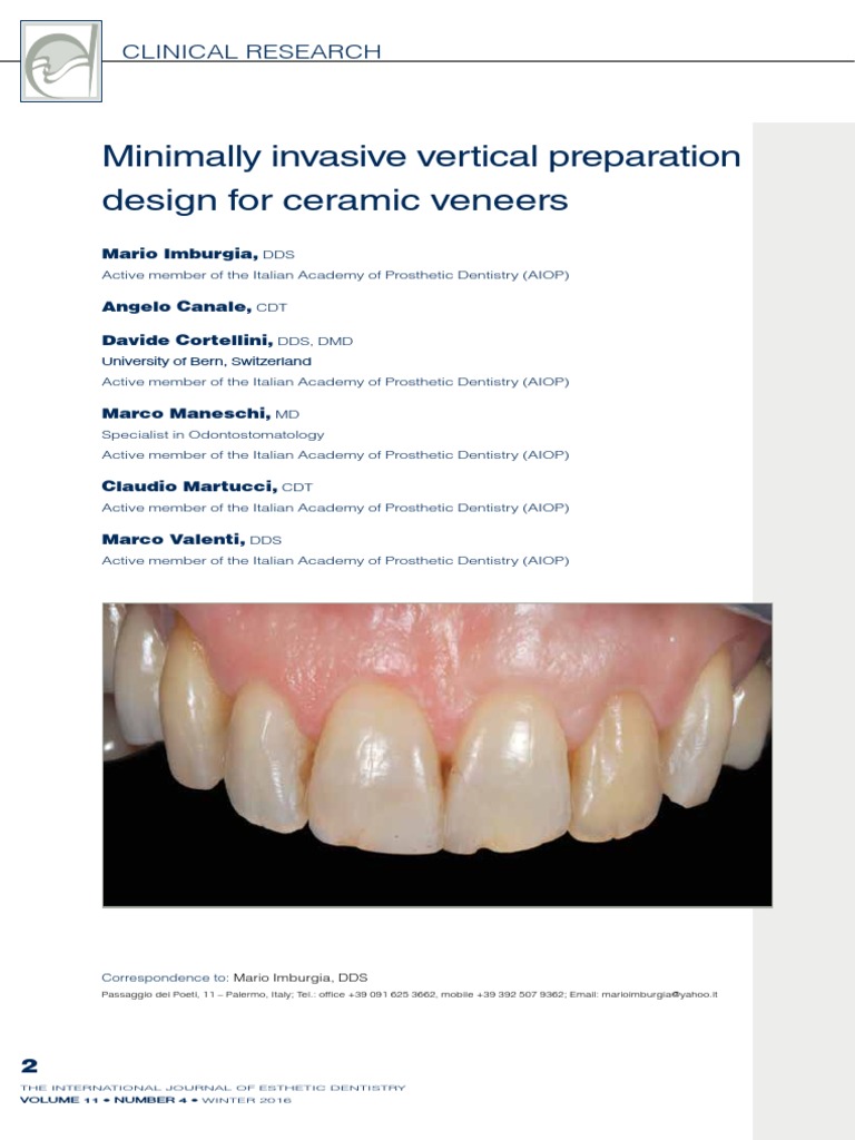 Minimally Invasive Vertical Preparation Design For Ceramic Veneers