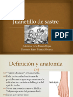 Juanetillo de Sastre