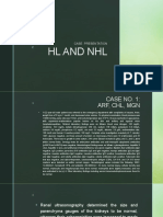 HL and NHL: Case Presentation