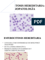 Esferocitosis Hereditaria Fisiopatología