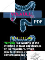 Volvulus 121023045321 Phpapp02