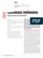 Cutaneous Melanoma: Atypical Variants and Presentations