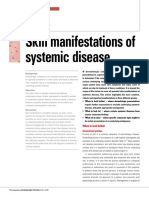 Skin Manifestation of Systemic Disease