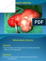 Miomatosis Uterina y Embarazo