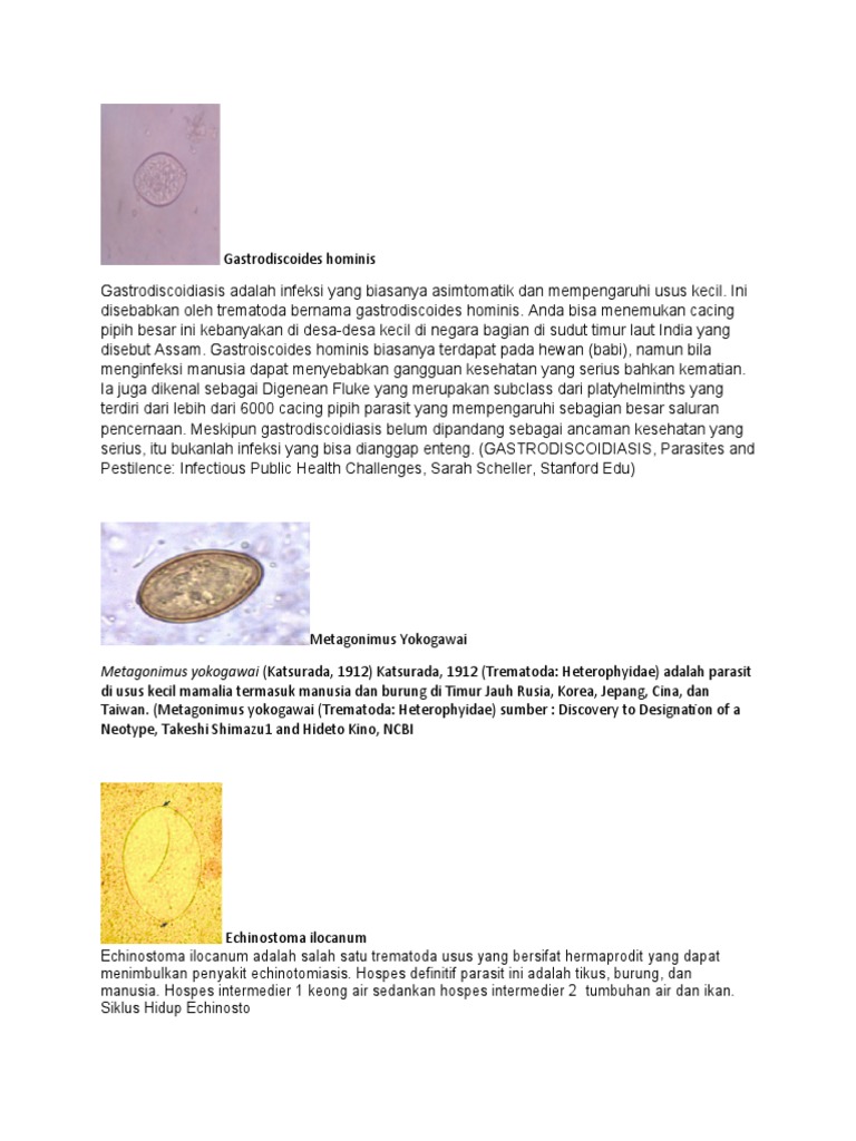 Gastrodiscoides Hominis dan Infeksinya | PDF