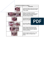 Movimientos Externos de La Lengua