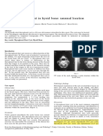 Thyroglossal Duct Cyst in Hyoid Bone: Unusual Location: The Journal of Laryngology & Otology