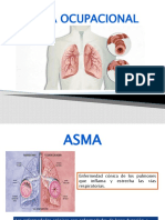 Asma Ocupacional