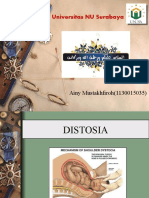 Distosia