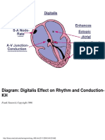 Diagram: Digitalis Effect On Rhythm and Conduction-KH