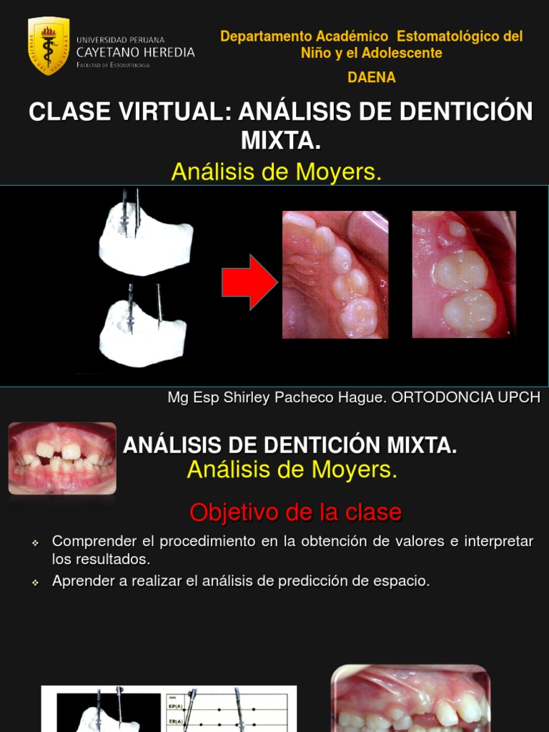 Análisis de Dentición Mixta | PDF | Ortodoncia | Diente