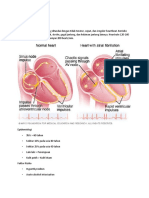 Atrial Fibrilasi