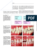 Dynamic Occlusion: 130 Manual Functional Analysis