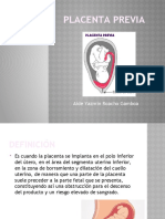 Placenta Previa, Dppni, Accretismo