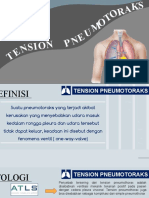 Tension Pneumo