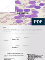 Leucemia Prezentare