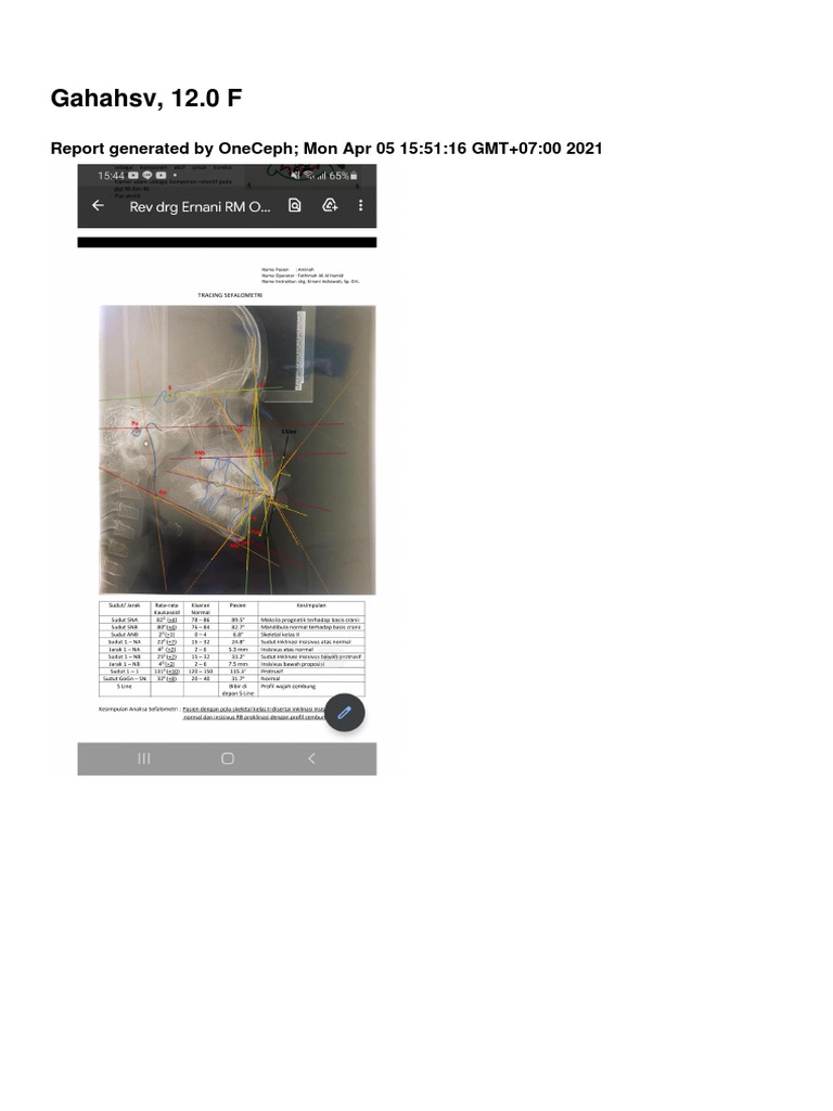 Gahahsv, 12.0 F: Report Generated by Oneceph Mon Apr 05 15:51:16 Gmt+07 ...