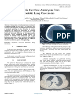 Neoplastic Cerebral Aneurysm From Metastatic Lung Carcinoma