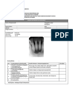 Albis'i Fatinzaki Ts - 40620076 - Interpretasi Periapikal Anterior RB