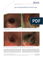 Dysphagia Due To Upper Esophageal Sphincter Disord