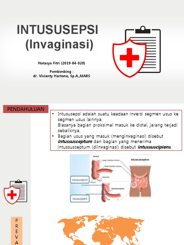 Tatalaksana Intususepsi pada Anak | PDF