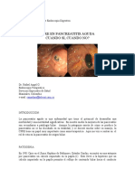 Pancreatitis Aguda y Cpre