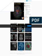 Pediatric Radiology в Instagram - «- P414 - Normal Thalamic Territories (Part I) - Next post theme - Variations (Part II) ... ? - Watch out! These images aren't real MR images!…»3