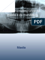 maxila-130811112850-phpapp02