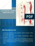 308141610 Aneurisma Aorta Abdominalis