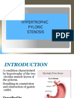 Hypertrophic Pyloric Stenosis