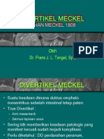 Divertikel Meckel
