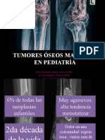 Tumores Oseos Malignos