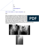 Caso Clinico 1 Osteomuscular 2021