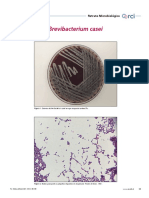 Brevibacterium casei: Características microbiológicas y clínicas