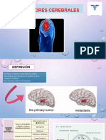 TUMORES CEREBRALES