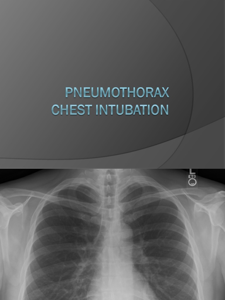 Ches Intubation | PDF | Self-Improvement | Wellness